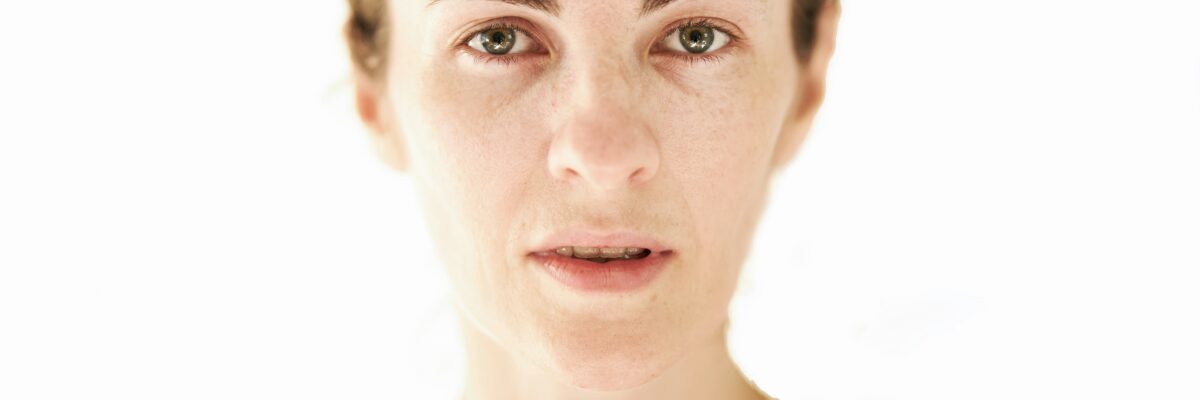 menopauzė veido plaukelių atsiradimas